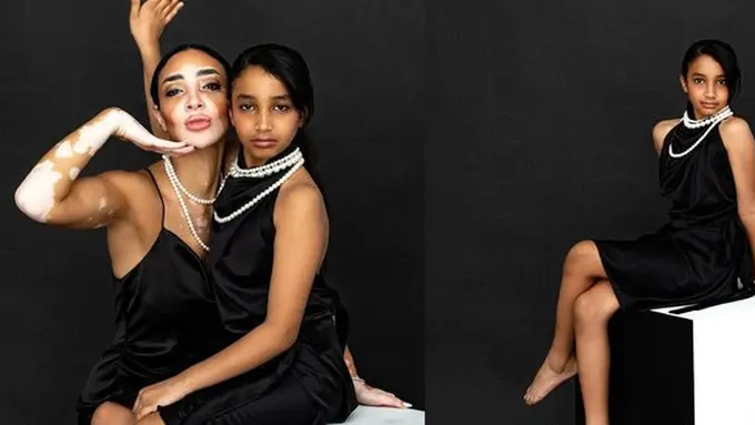 Potret Cantik Lala, Putri Logina Salah Miss Universe Mesir 2024 yang Juga Sudah Jadi Model. (instagram/lala_star2015)