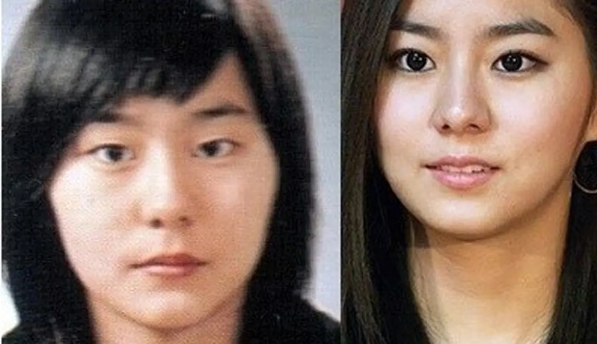 Pada Januari 2010, Uee mengatakan saat episode ‘Sangsang’ jika ia telah melakukan operasi pada matanya. “Aku hanya memperbaiki mata sedikit.” (via dramafever.com)