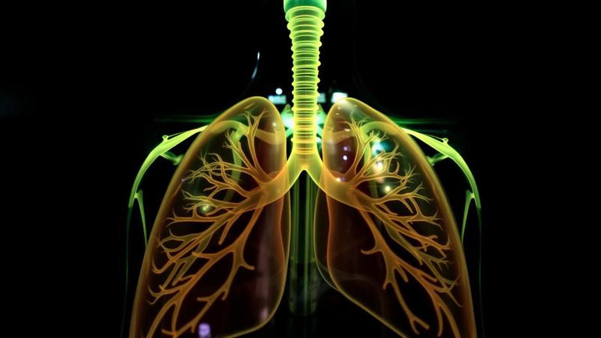 Tidak Merokok tapi Idap Kanker Paru, Ini 5 Penyebabnya