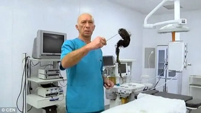 Sering Gigit Rambut, Gadis Ini Terkena Sindrom Rapunzel