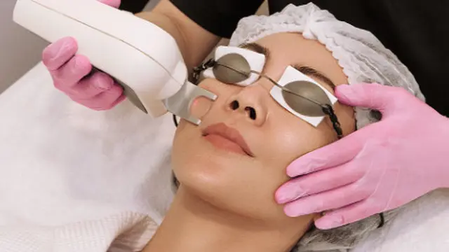 Perawatan Melasma Berbasis Klinik Kecantikan dari Skincare Lokal