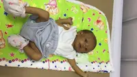 Azkalubik Adhyastha Fatkhulloh, 2 bulan, Didiagnosis Dokter Menderita Penyakit Hati Langka, Atresia Billier. (Kitabisa.com)