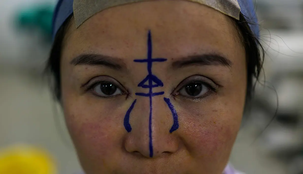 Chen Yan (35) berpose sebelum menjalani operasi plastik di Huamei Medical Cosmetology Hospital di Shanghai, Tiongkok (22/9). Seiring keinginan untuk terlihat bagus di media sosial, operasi plastik berkembang pesat di Tiongkok. (AFP Photo/Chandan Khanna)