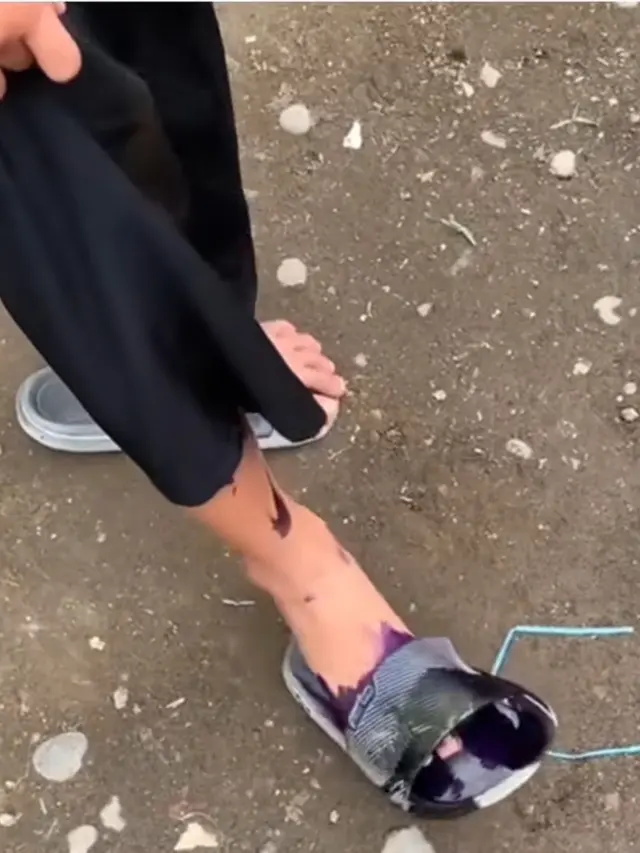Netizen Korban Tinta Pemilu