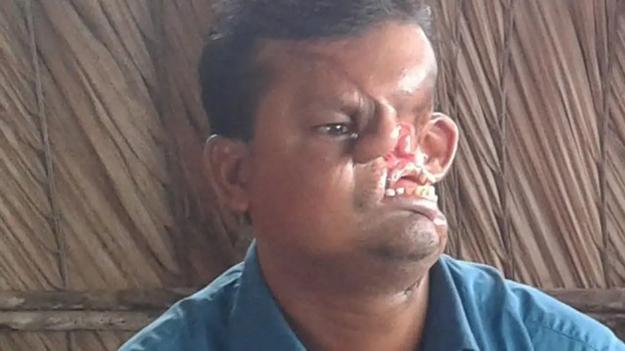 Naas, Muka Hancur Diserang Harimau Nelayan Ini Banjir Bully