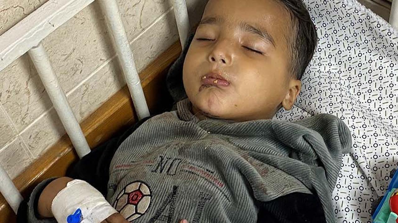 Sejak konflik terbaru meletus pada 7 Oktober 2023 lalu, Ahmad Shabat terkena serangan biadab Israel sebanyak dua kali.