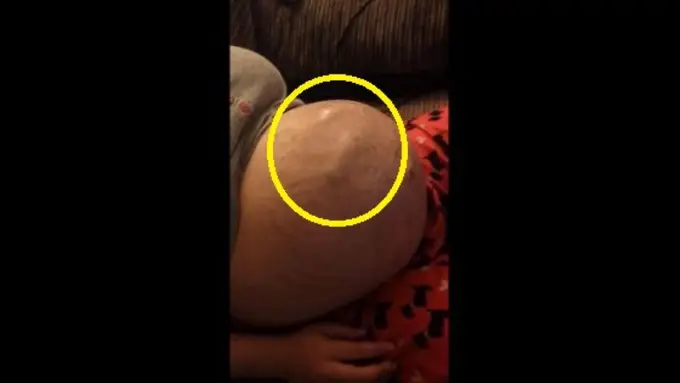 Jabang Bayi Tendang Perut Ibu, Kakinya Sampai Terlihat
