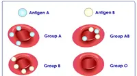 Sejumlah penyakit bisa juga tergantung dari golongan darah, lho.