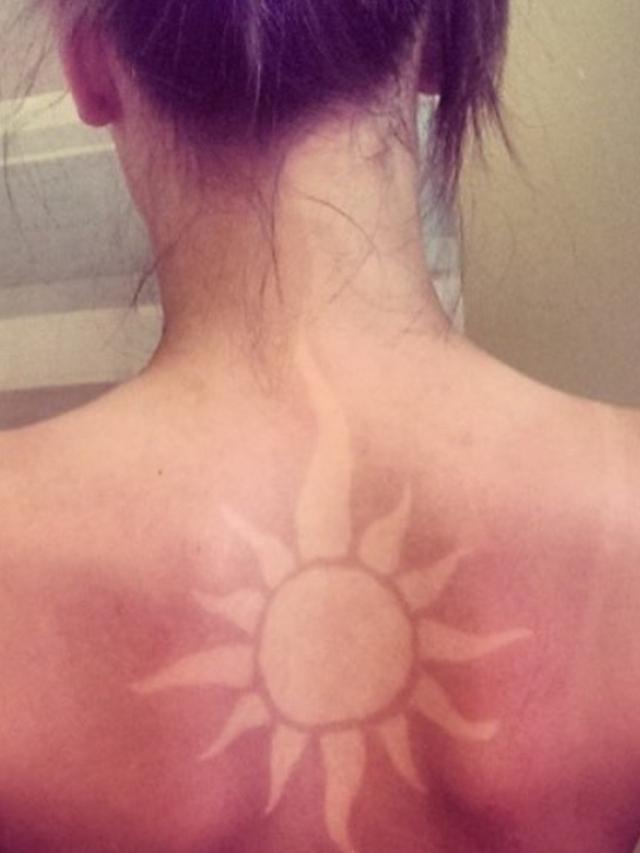 Tren Sunburn Tatoo Kembali Viral Ketahui Bahayanya Bagi Kesehatan Citizen6 Liputan6 Com