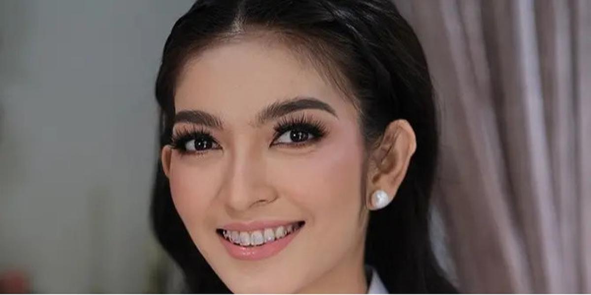 Gaya Terbaru Selvi Ananda Pakai Behel, Riasan Soft Glam-nya Bikin Pangling