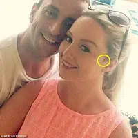 Tahi lalat yang sudah dia miliki selama 10 tahun, lalu berubah menjadi kanker ganas. 