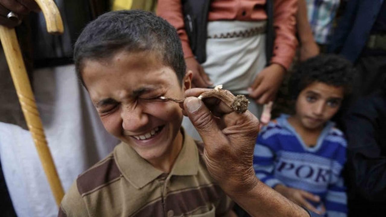 Ramadan, pria Yaman ramai-ramai bersihkan mata dengan kohl