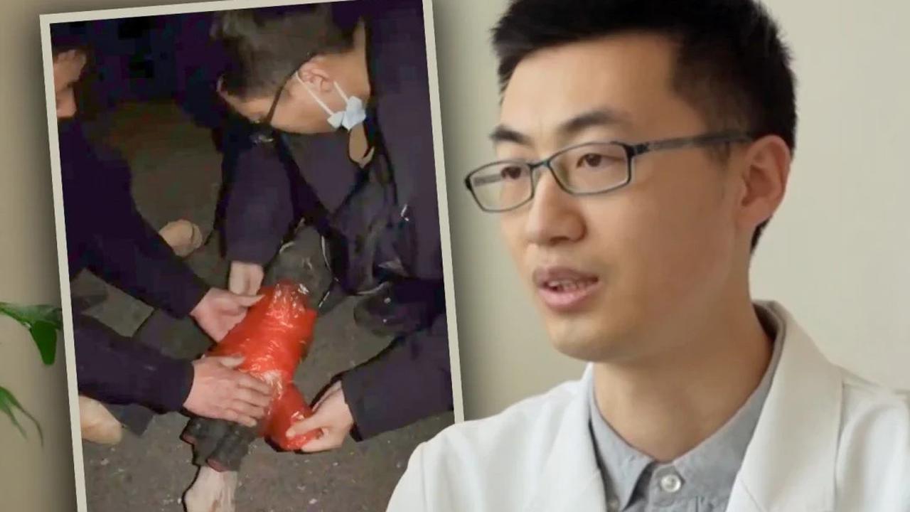 Dokter Ini Selamatkan Pasien Patah Tulang Pakai Raket Badminton dan Kantong Plastik