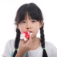 ilustrasi anak mimisan/copyright Shutterstock