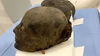 Rambut mumi dianalisis oleh para ilmuwan dari institut Kurchatov di Moskow untuk mengetahui bagaimana rambut itu dilestarikan dengan sangat baik. Jasad-jasad itu hidup sekitar 3.000 tahun yang lalu. (Kurchatov Institute)