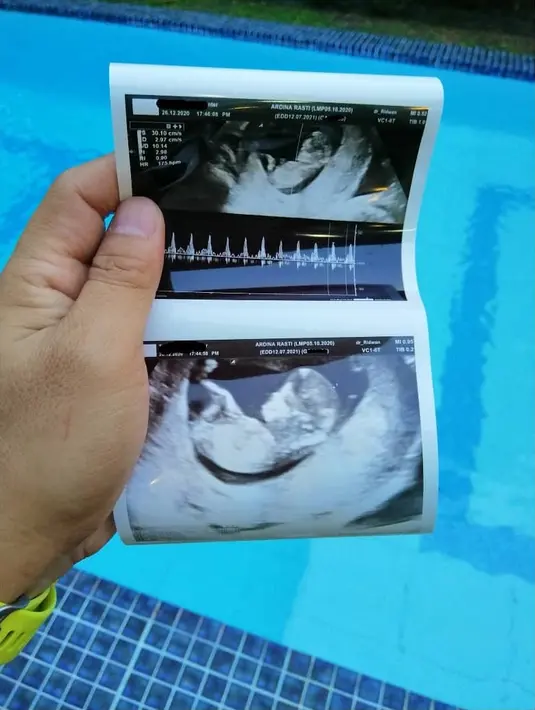 Ardina Rasti (Instagram/arieandika10)