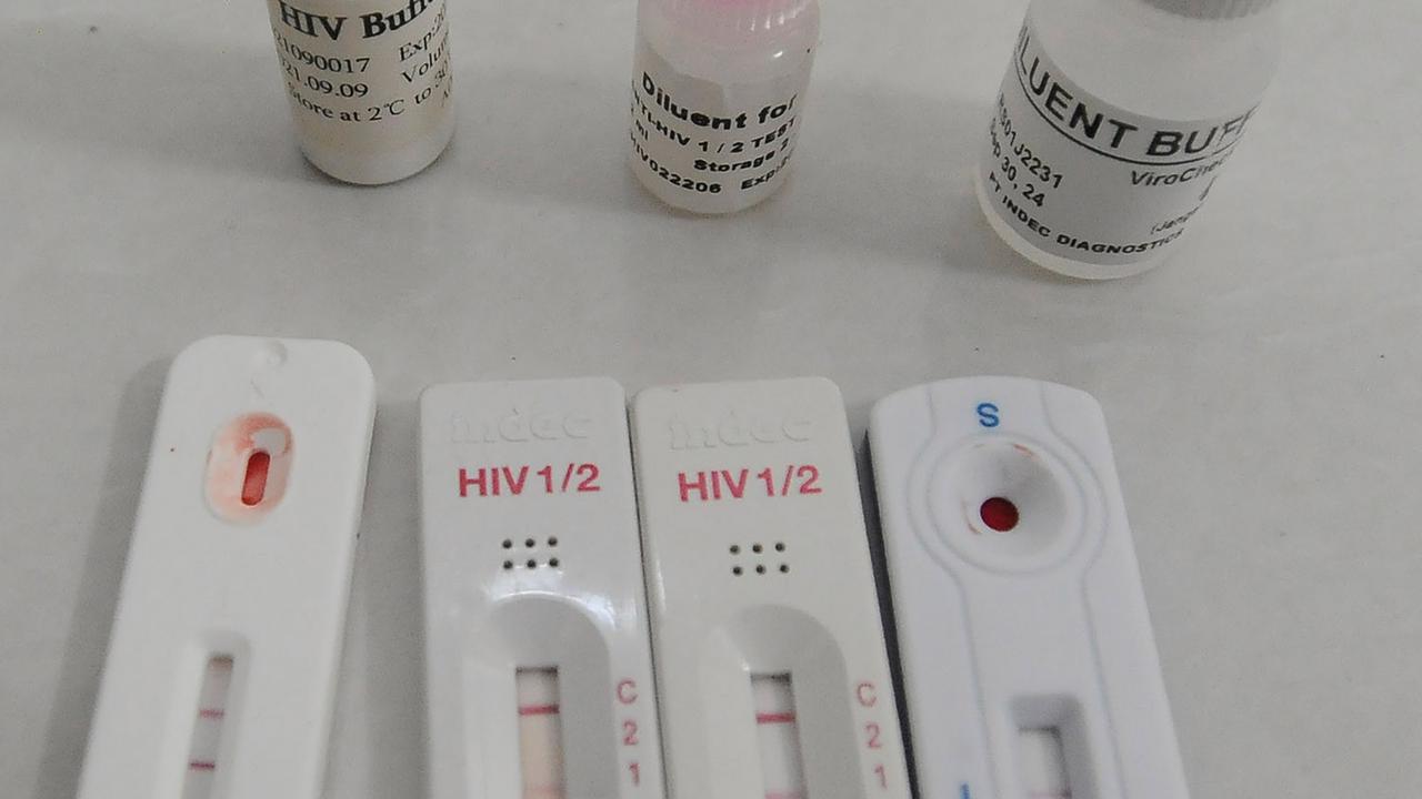 WHO: HIV dan Infeksi Menular Seksual Lain Sebabkan 2,7 Juta Kematian Setiap Tahun