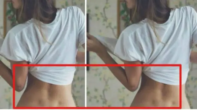 [bintang] 7 Fakta Kepribadian Orang yang Punya Lesung di Punggung