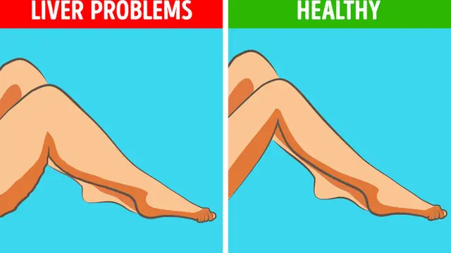 Kaki Sakit Gejala Penyakit Serius