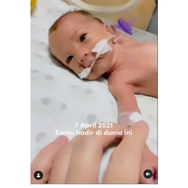 6 Potret Kondisi Anzel Anak Audi Marissa ketika Lahir Prematur, Kini Genap 3 Tahun