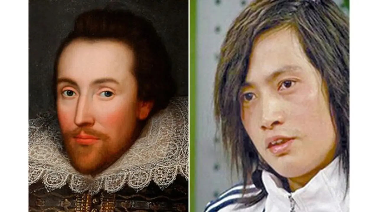 Penggemar William Shakespeare, Pria Ini Operasi Plastik Wajahnya