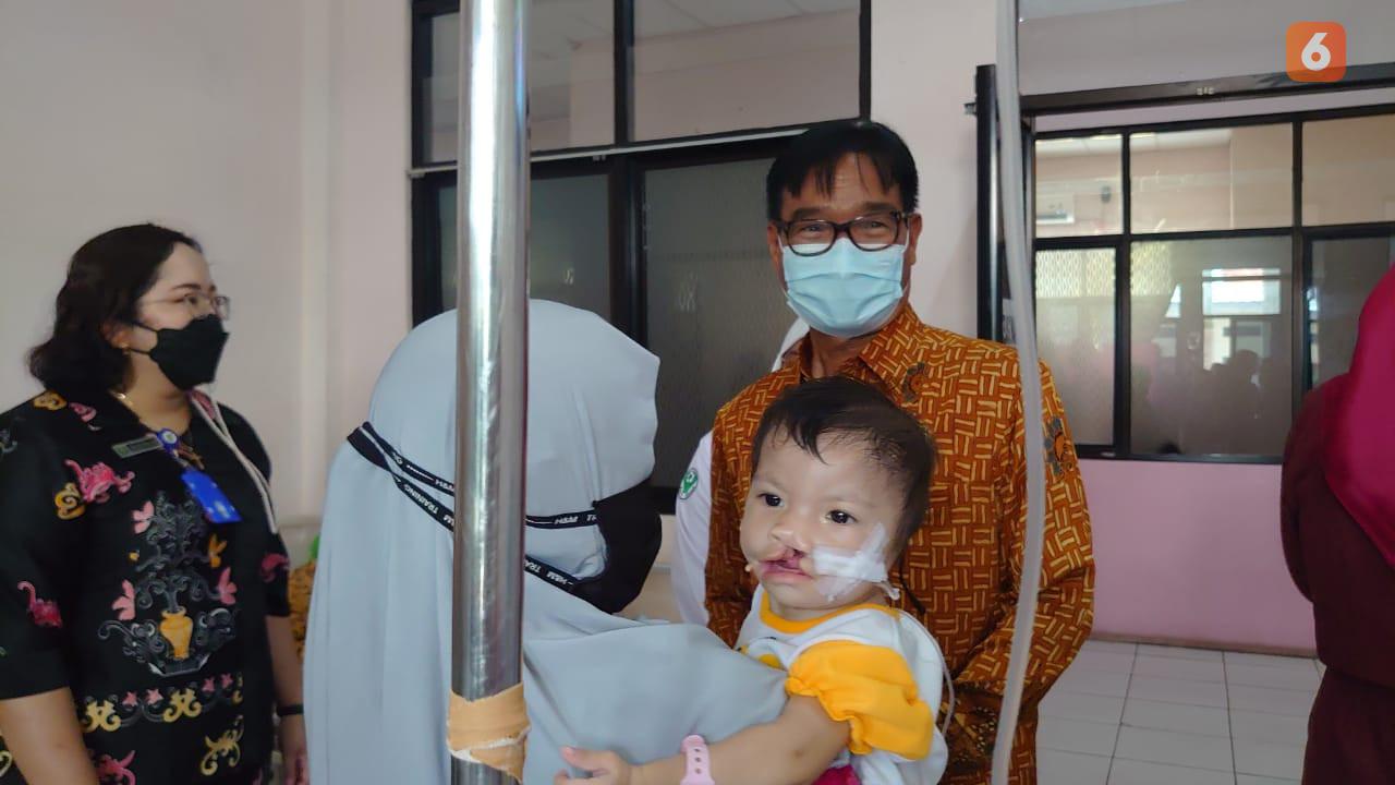 Operasi Bibir Sumbing