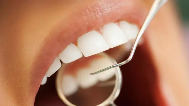 Suka Konsumsi Gula Bikin Gigi Berlubang, Benarkah?