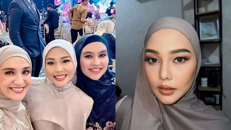 Foto Dara Arafah Dikira Netizen Oplas Dagu