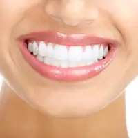 Ilustrasi gigi putih bersih. (purewow.com).