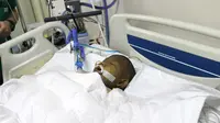 Bocah Hafidz Berhasil Transplantsi Hati di RS Pertamedika Sentul Berkat Dahlan Iskan