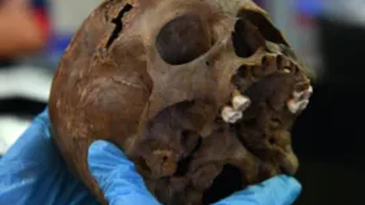 Antropologi fisik di lokasi menyatakan bocah itu berusia 10 tahun saat meninggal dengan gigi terkikis dan tanda-tanda infeksi didalam mulutnya.