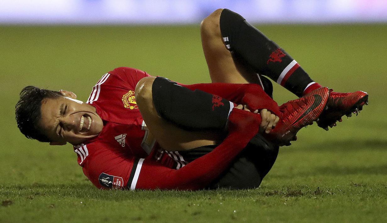 Alexis Sanchez jatuh kesakitan saat berebut bola dengan pemain Yeovil Town pada babak keempat Piala FA di Huish Park, Yeovil, (26/1/ 2018). Setan Merah menang 4-0. (Nick Potts/PA via AP)