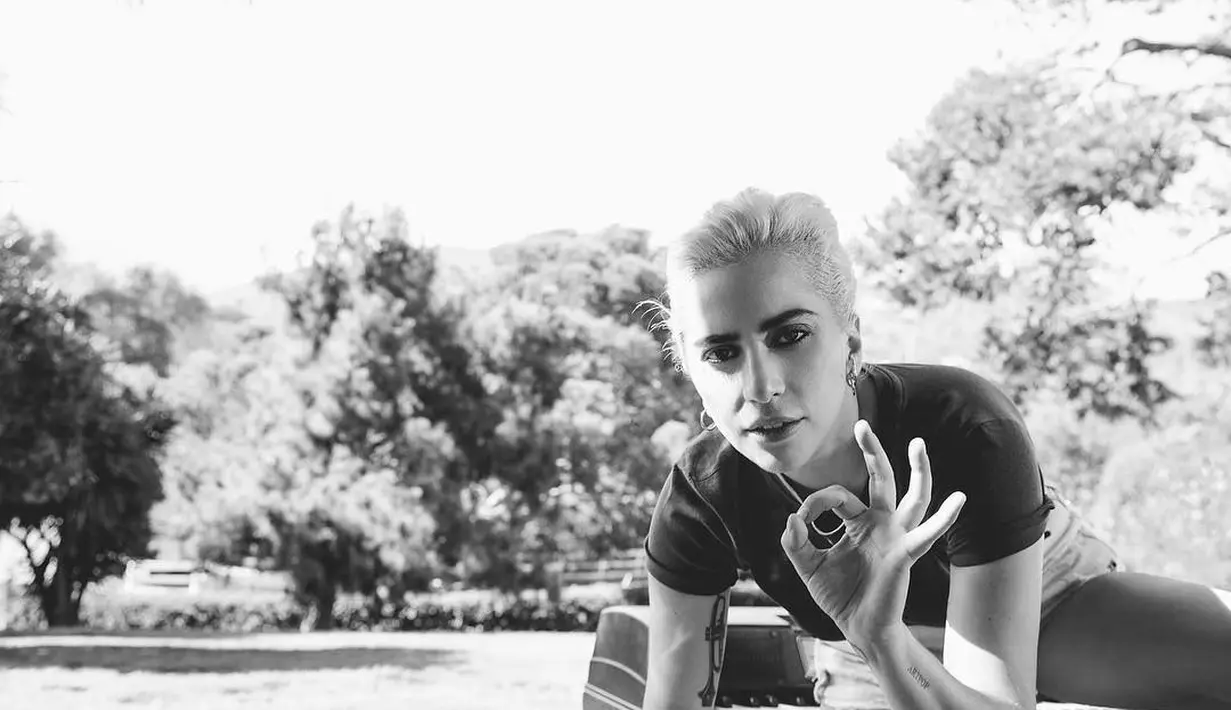 Kini Lady Gaga pun sedang dalam perawatan para profesional demi kesembuhannya. (instagram/ladygaga)