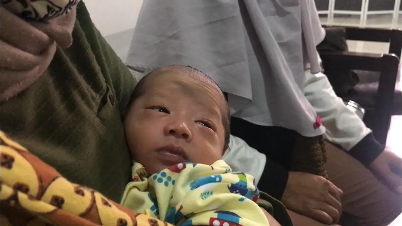 Bayi Menangis Darah