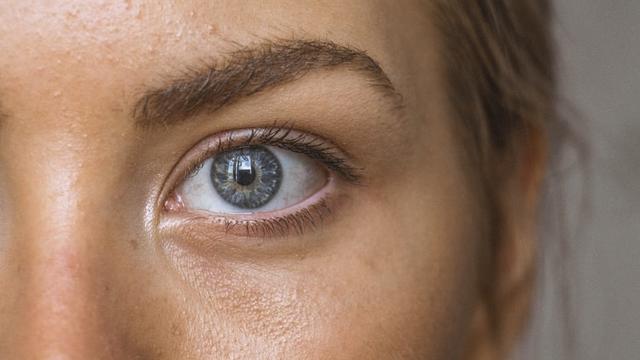 Iritasi oleh disebabkan penyakit mata penyakit iritasi
