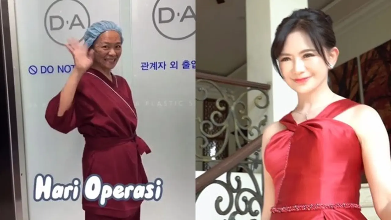 6 Potret Puspa Dewi Sebelum dan Sesudah Oplas, Nenek Viral Awet Muda 56 Tahun