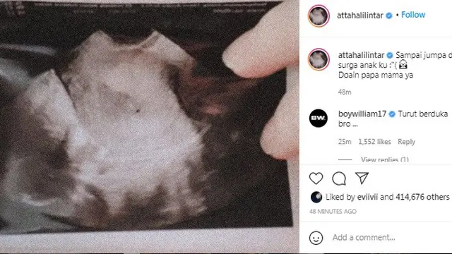 Atta Halilintar dan Aurel Hermansyah