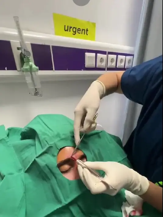 Verrell Bramasta saat menjalani proses jahitan karena alisnya robek akibat terbentur sangat keras. (Instagram @bramastavrl) - 3