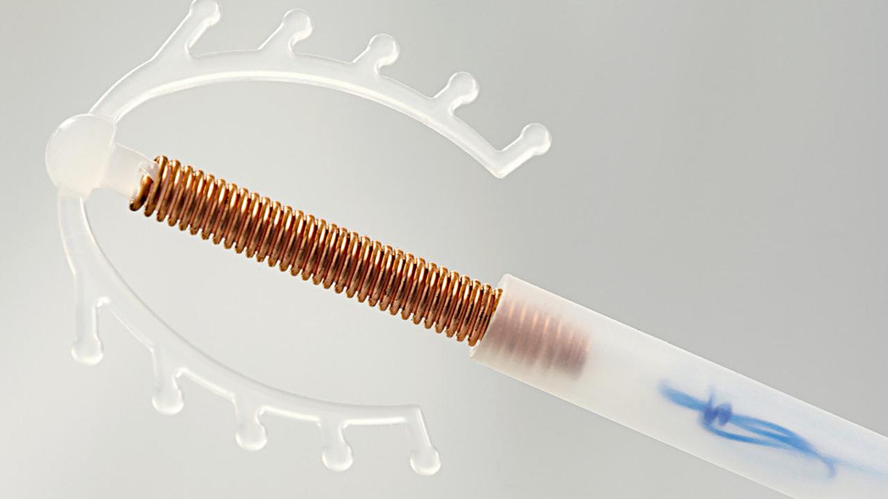 Alat KB IUD (iStock)