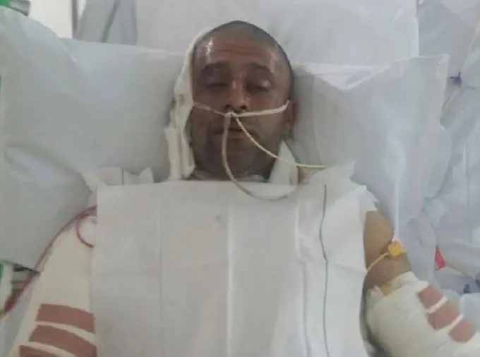 Jameel Mukhtar mendapat perawatan khusus dan sempat koma beberapa hari (GOFUNDME)