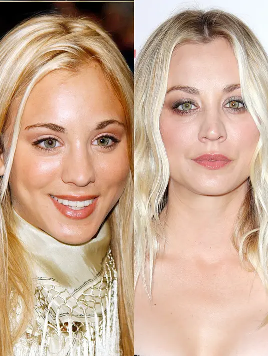 Kaley Cuoco mengaku bahwa ia melakukan operasi hidung dan payudara. (REX/Shutterstock/HollywoodLife)