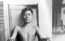 Penyebab Penyakit Beri-beri yang Perlu Diwaspadai, Begini Cara Mengatasinya