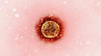 Ilustrasi Cacar Air (Foto: Unsplash/National Institute of Allergy and Infectious Diseases)