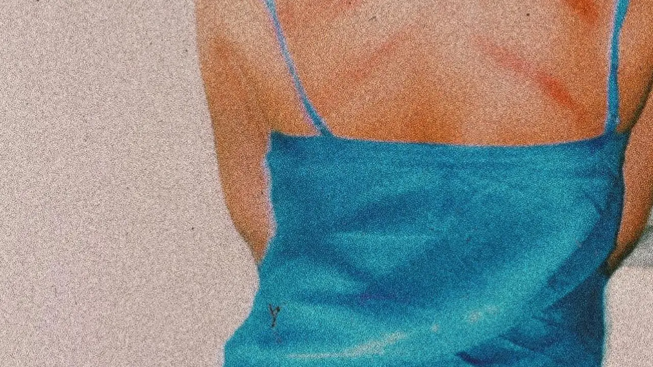 Marion Jola pamer punggung bekas kerokan (https://www.instagram.com/p/CAxxu7mJBmr/)