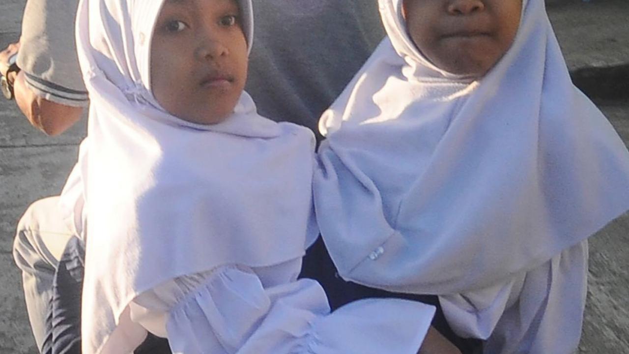 Al Dewi dan Al Putri merupakan kembar siam dempet perut dan divonis tidak bisa dipisah sejak lahir. Ibunya sudah meninggal sekitar 2 tahun lalu dan kini tinggal bersama  ayah, kakanya dan neneknya.