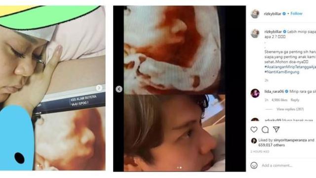 Foto USG kehamilan Lesti Kejora yang diunggah Rizky Billar