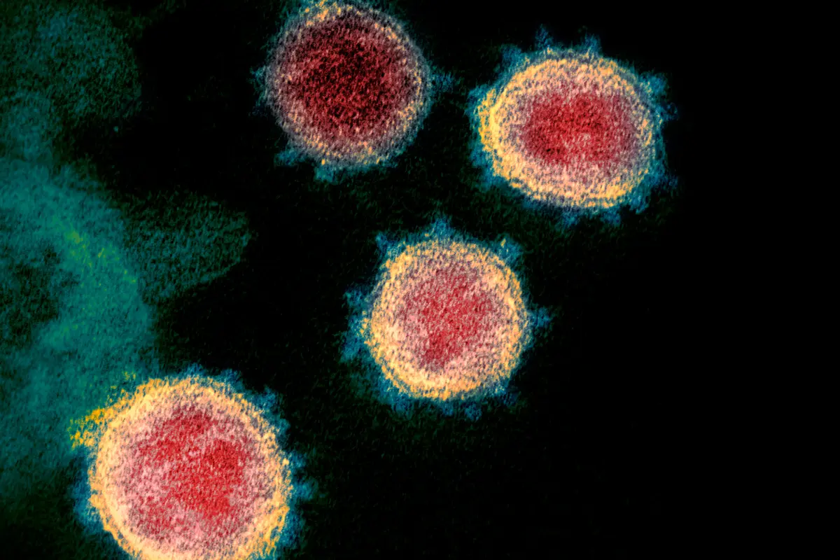 Virus Corona COVID-19 dari Mikroskop