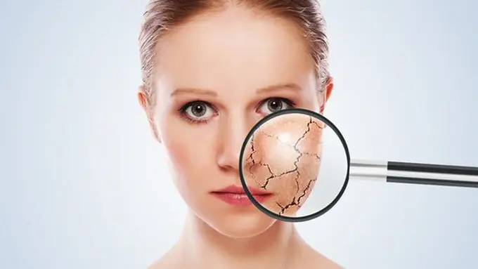 Kulit kering akan membuat wajah tampak kusam/copyright: thinkstockphotos.com