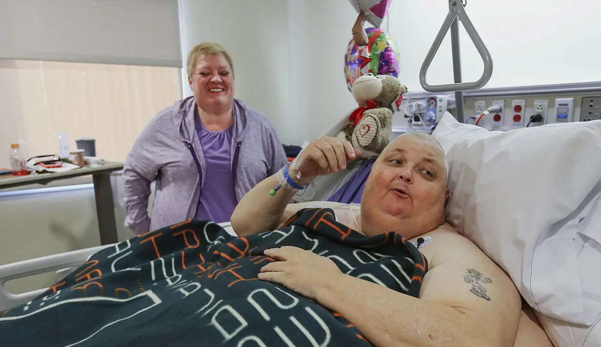 Kitty Logan mendampingi suaminya, Roger Logan (57) yang menjalani perawatan di RS Bakersfield Memorial, California, 2 Februari 2017. Roger usai menjalani pengangkatan tumor seberat 58,97 kilogram. (Henry A. Barrios/The Bakersfield Californian via AP)
