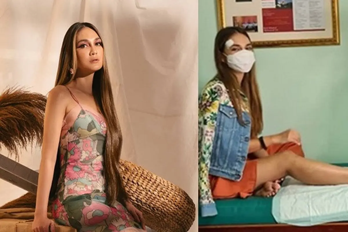 Alami Patah Tulang Metatarsal, Ini 6 Potret Kondisi Terbaru Luna Maya